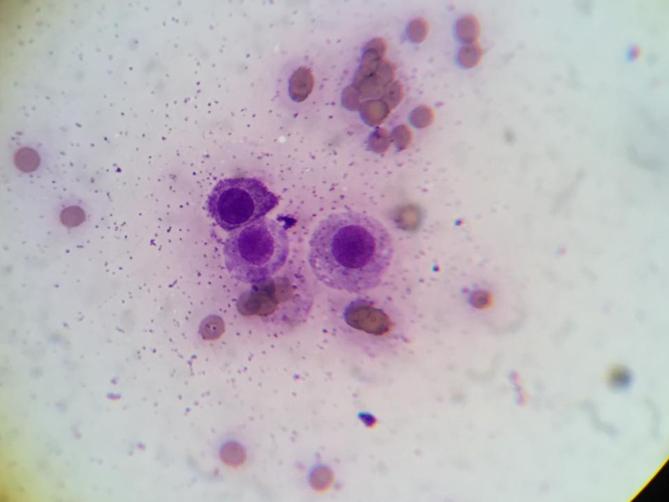 Mastceller fra hund med mastcelletumor, karakteristiske granula synlige ved cytologi