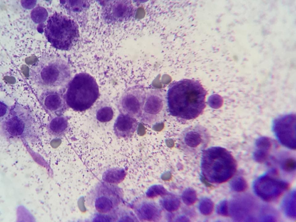 Cytologisk præparat fra mastcelletumor hos hund med tydelige intracellulære granula