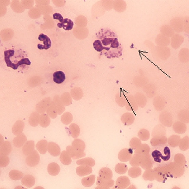Cytologi quiz til dyrlæger: Blod udstrygning fra hund med feber og neutrofili