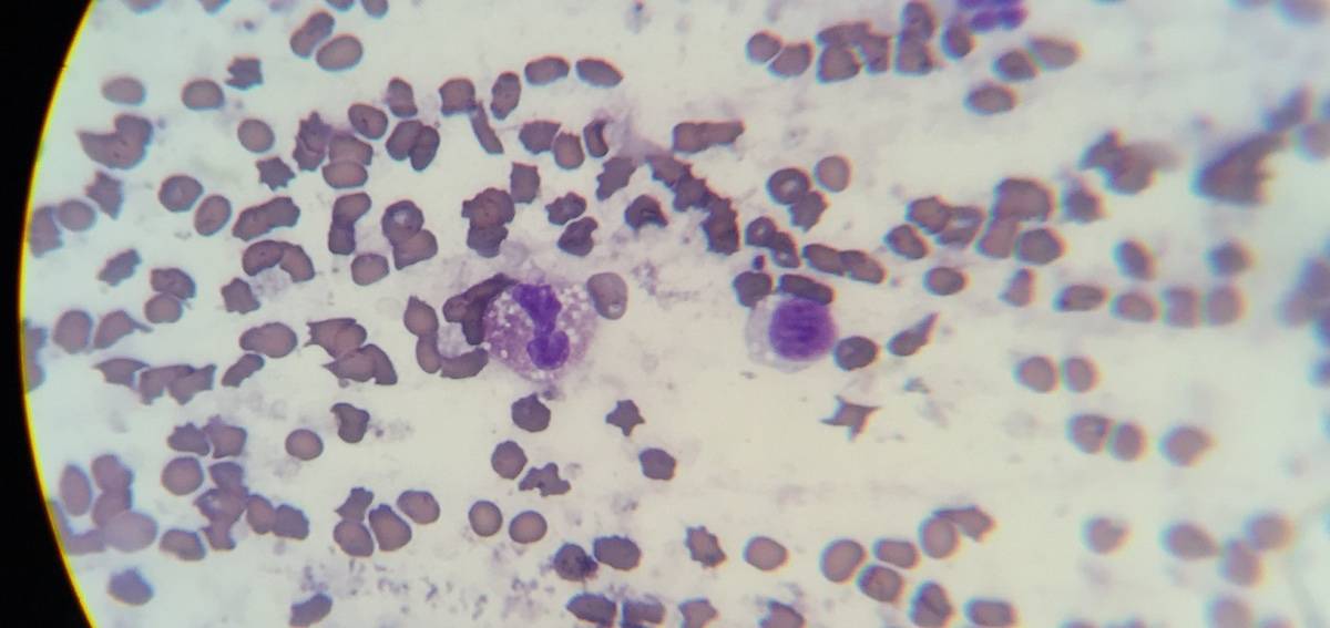 Celler fra mistænkt osteosarkom-tumor hos hund