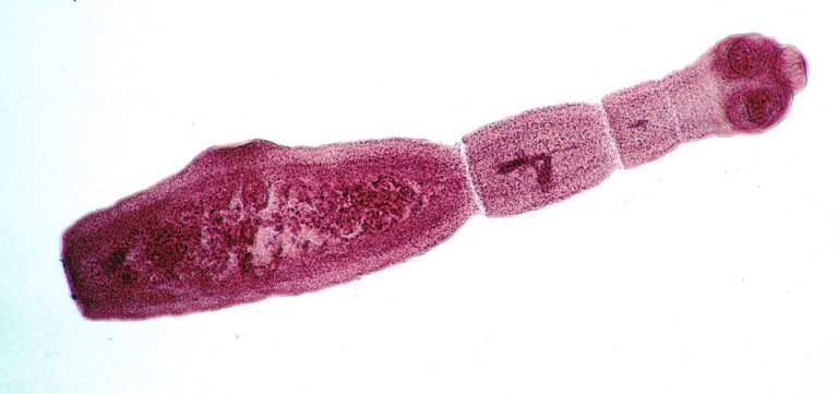 AA4323: Echinococcus multilocularis (Rævens dværgbændelorm)