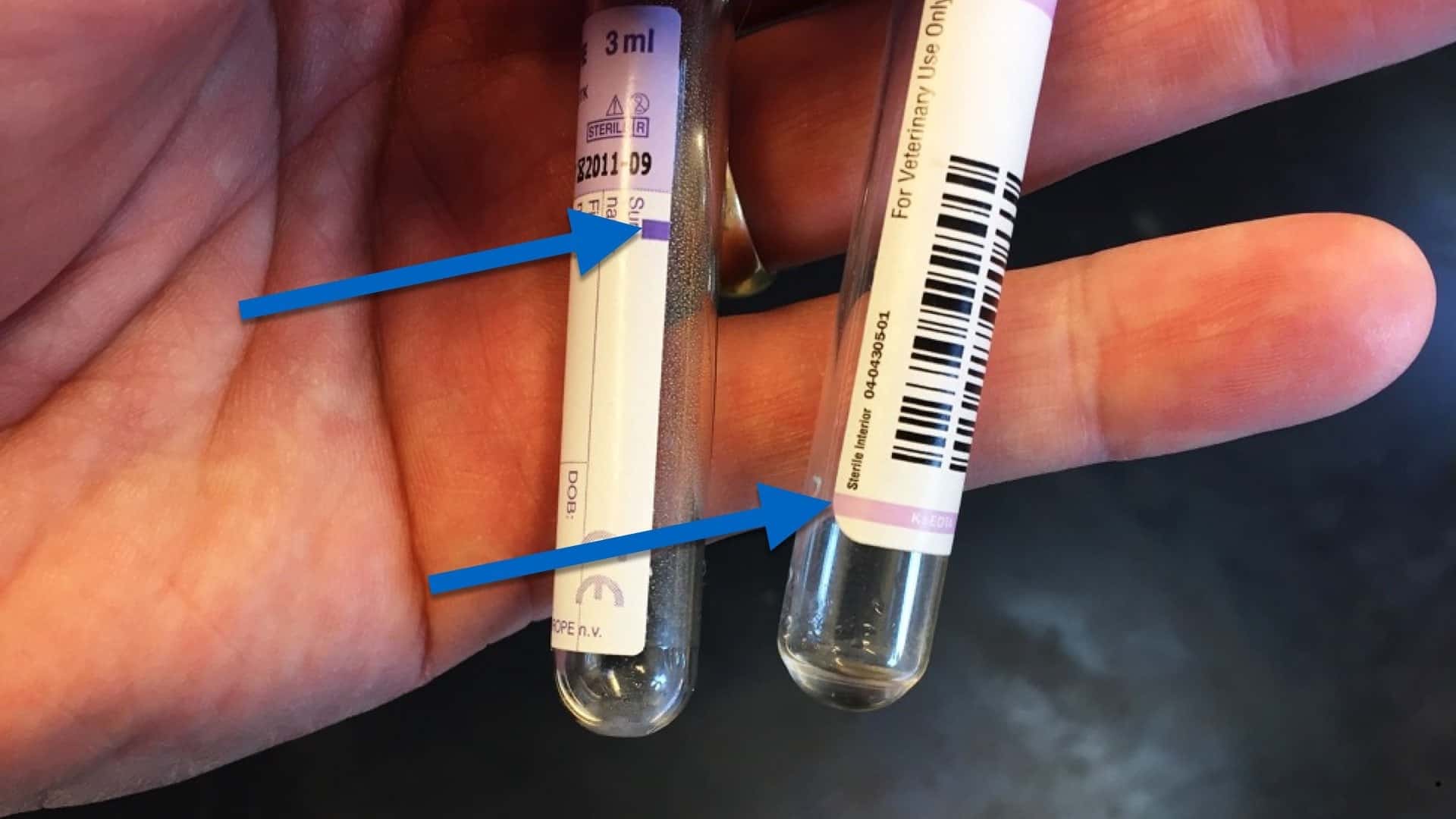 EDTA blodprøve glas med forskellig markering