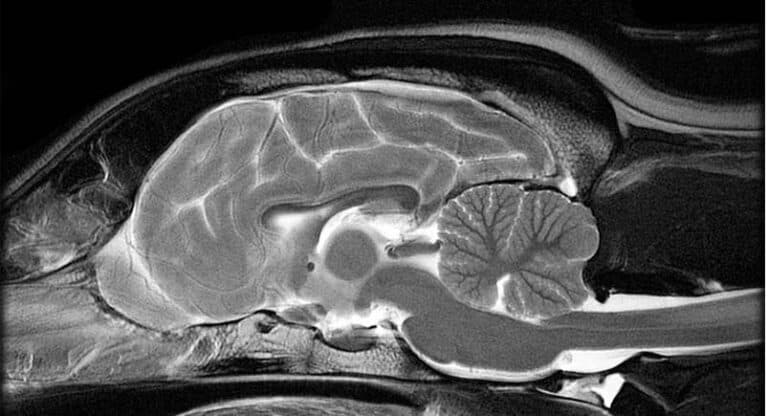 NA91: Idiopatisk primær epilepsi