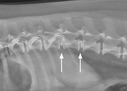 Røntgenbillede af hund med intervertebral disk disease (IVDD), der viser forkalkning og kollaps af intervertebrale rum i thorakolumbalregionen.