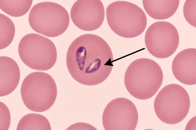 Mikroskopibillede af erytrocyt med tydelig infektion af Babesia canis, markeret med pil. Parasitten ses som to pæreformede strukturer farvet mørkelilla med Giemsa-farvning, omgivet af normale røde blodlegemer.