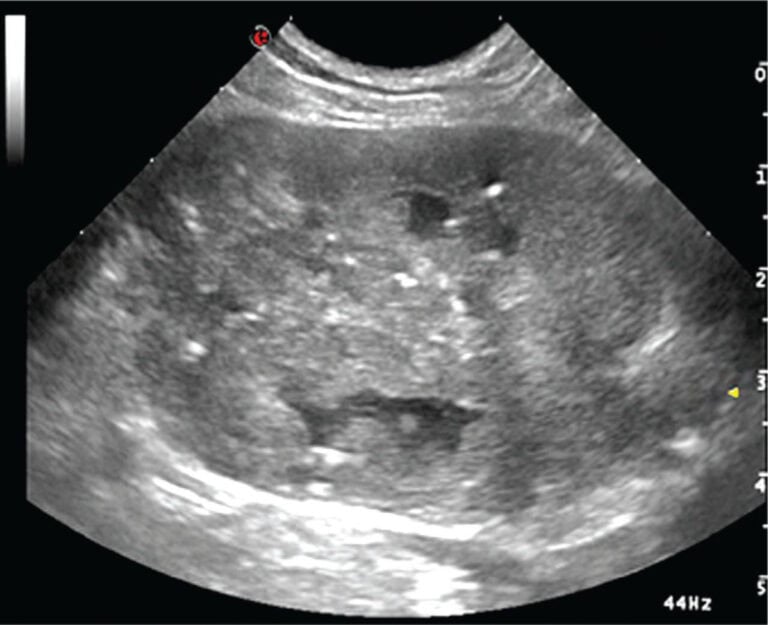 Benign Prostatahyperplasi (BPH) hos hunde
